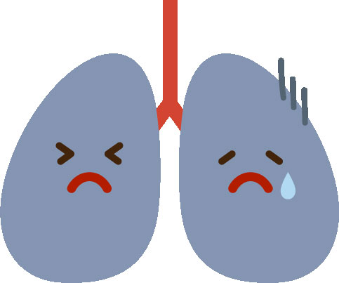 肺を圧迫